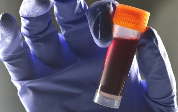 Дослідники встановили зв’язок між групою крові та ймовірністю діабету 2 типу